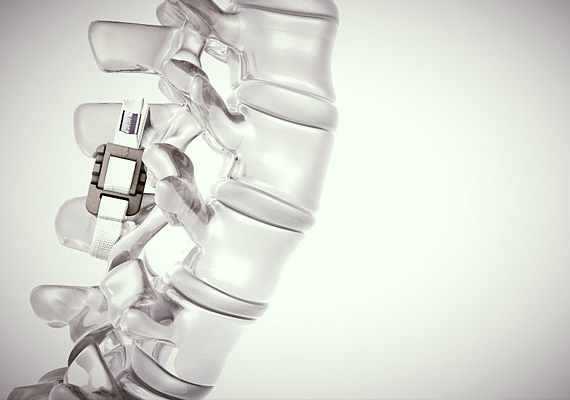 Catégorie : image de synthèse - Film 3d sur la simulation de pose d’implants sur lombaires